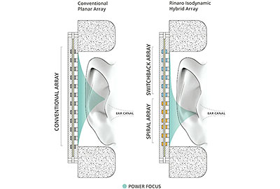 Rinaro-Isodynamic-Hybrid-Array-Driver